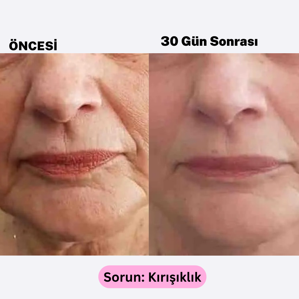 Yüz Kası Uyandırıcı EMS Cihazı | Doğal Gıdık ve Kırışıklık Giderici