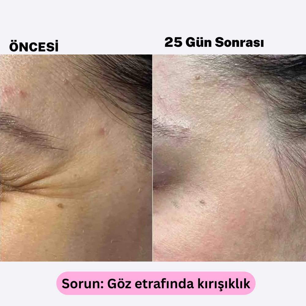 Yüz Kası Uyandırıcı EMS Cihazı | Doğal Gıdık ve Kırışıklık Giderici